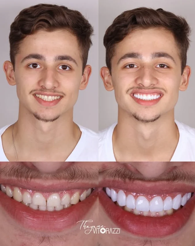 Caso clínico real de antes e depois