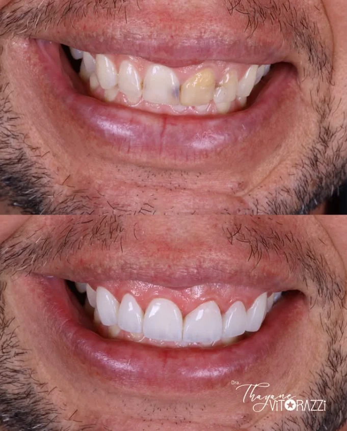 Caso clínico real de antes e depois